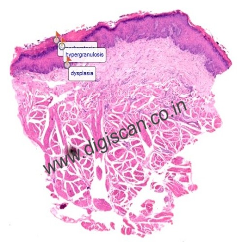 BDS Complete Digital Slides Set (Histology, Dental Anatomy & Oral Pathology)